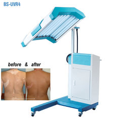 Phototherapyの処置UVBライト療法機械、UVBの狭帯域の軽い療法